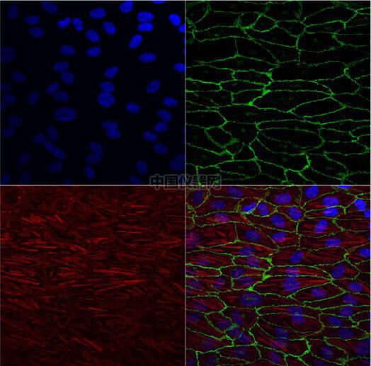 流體剪切力實驗：流體環(huán)境下的HUVEC細(xì)胞培養(yǎng)，真實還原體內(nèi)環(huán)境